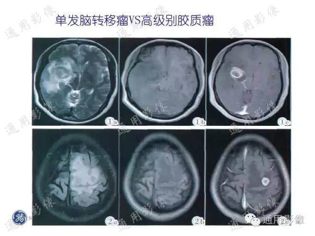 【PPT】PWI原理及临床应用