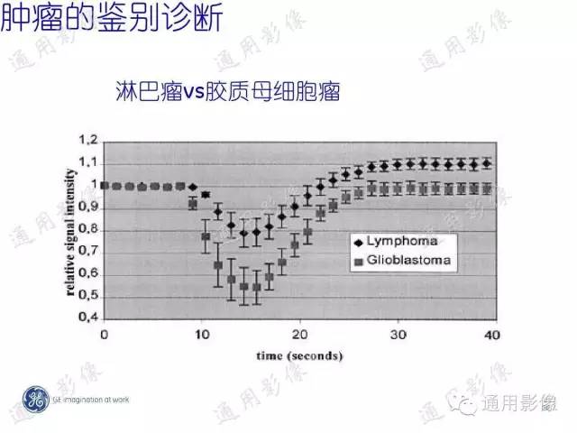 【PPT】PWI原理及临床应用