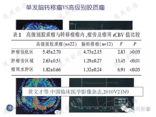 【PPT】PWI原理及临床应用