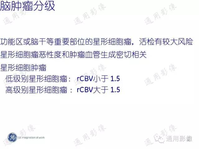 【PPT】PWI原理及临床应用