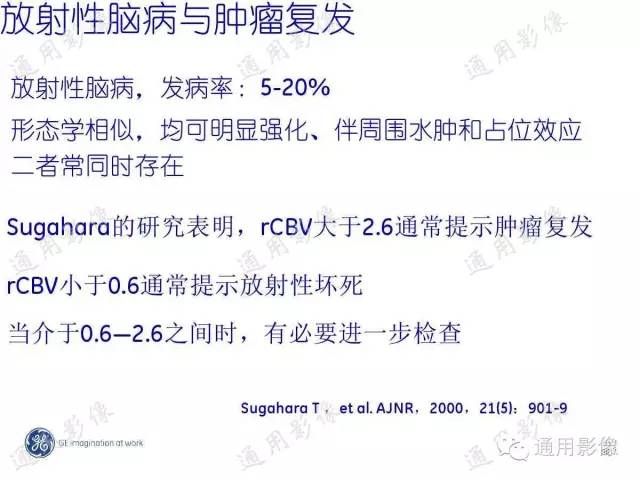 【PPT】PWI原理及临床应用