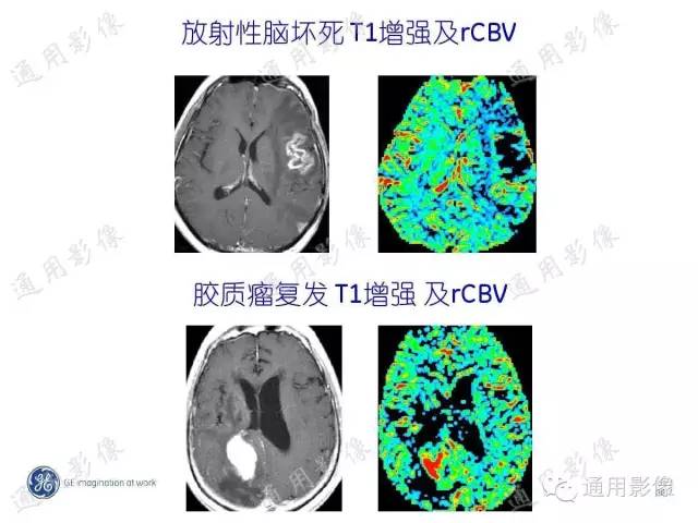 【PPT】PWI原理及临床应用