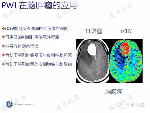 【PPT】PWI原理及临床应用