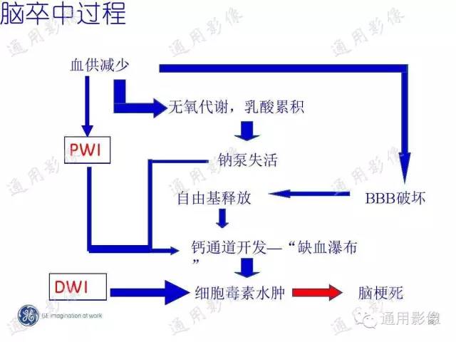【PPT】PWI原理及临床应用