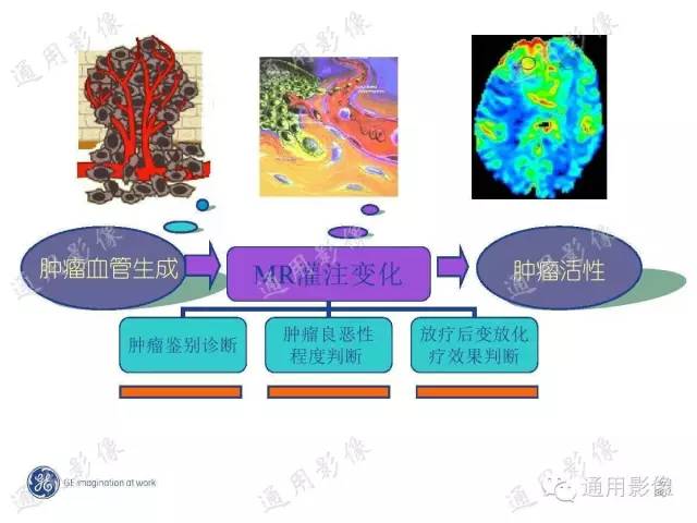 【PPT】PWI原理及临床应用