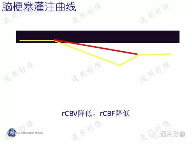 【PPT】PWI原理及临床应用