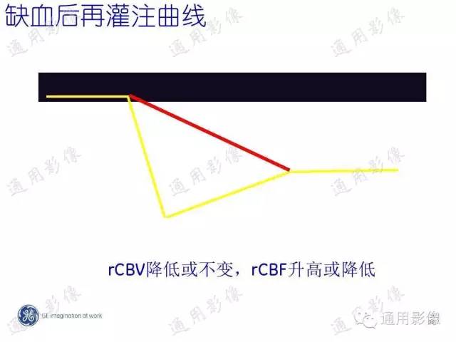 【PPT】PWI原理及临床应用