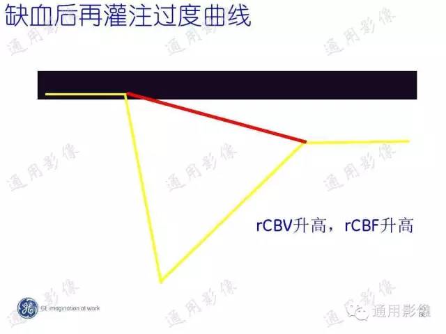 【PPT】PWI原理及临床应用