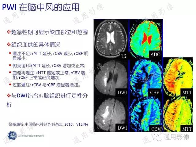 【PPT】PWI原理及临床应用