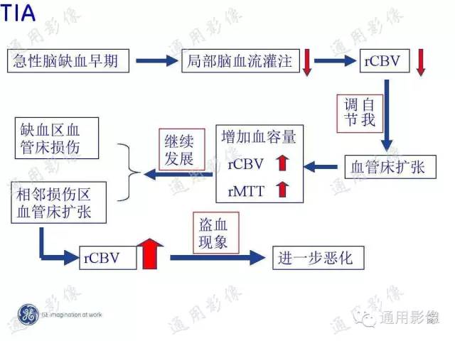 【PPT】PWI原理及临床应用