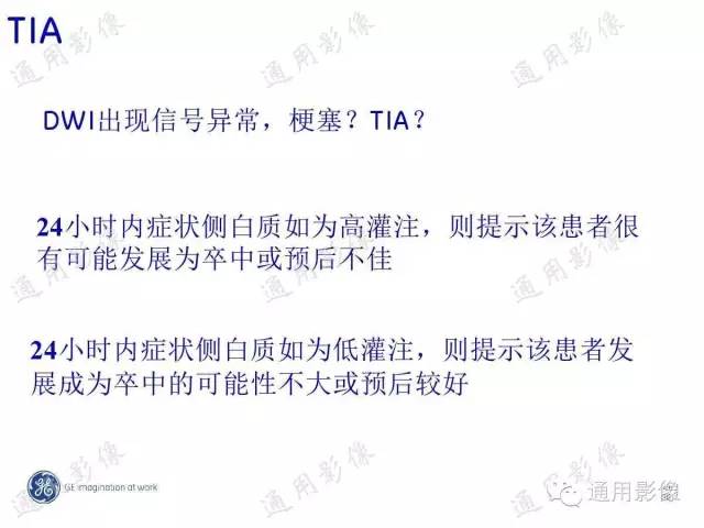【PPT】PWI原理及临床应用