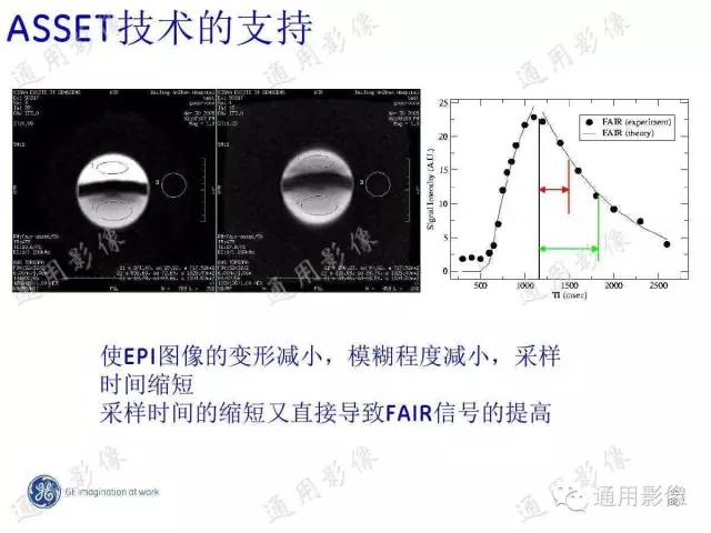【PPT】PWI原理及临床应用