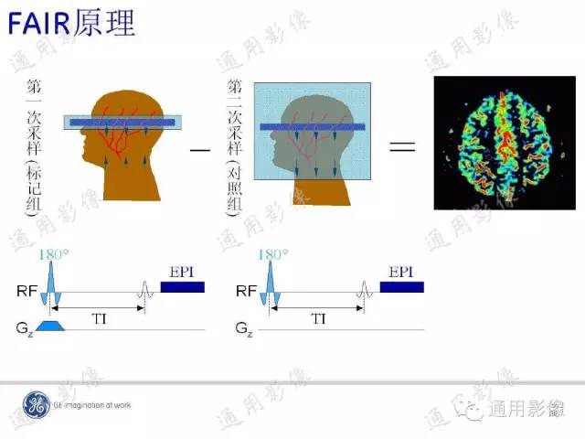 【PPT】PWI原理及临床应用