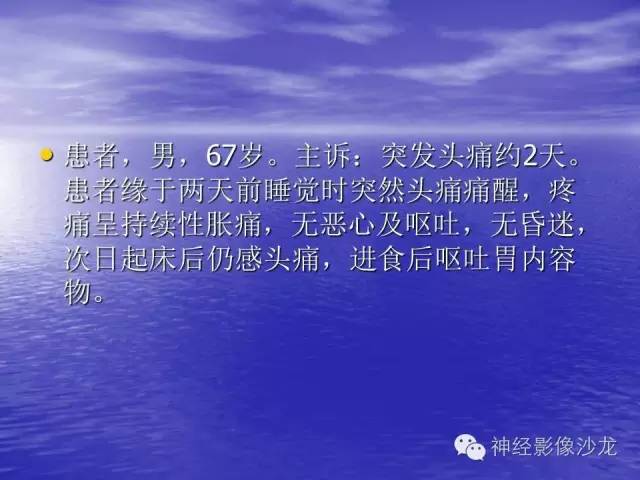 【病例】脑胶质母细胞瘤伴肿瘤卒中一例CT及MR影像表现