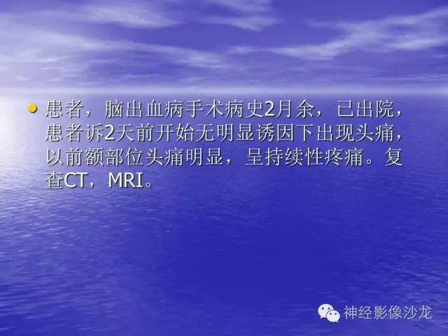 【病例】脑胶质母细胞瘤伴肿瘤卒中一例CT及MR影像表现
