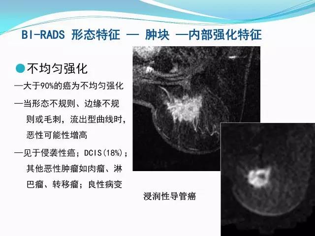 【PPT】新版乳腺MR BI-RADS术语及分类的解读