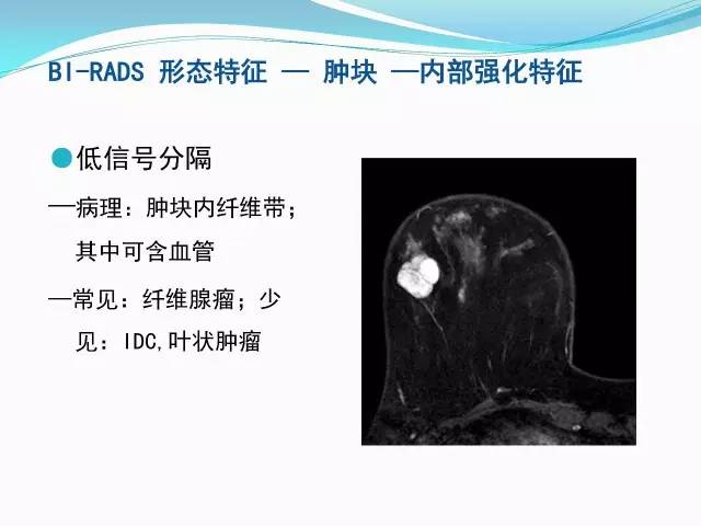 【PPT】新版乳腺MR BI-RADS术语及分类的解读