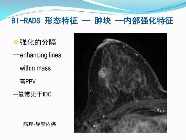 【PPT】新版乳腺MR BI-RADS术语及分类的解读