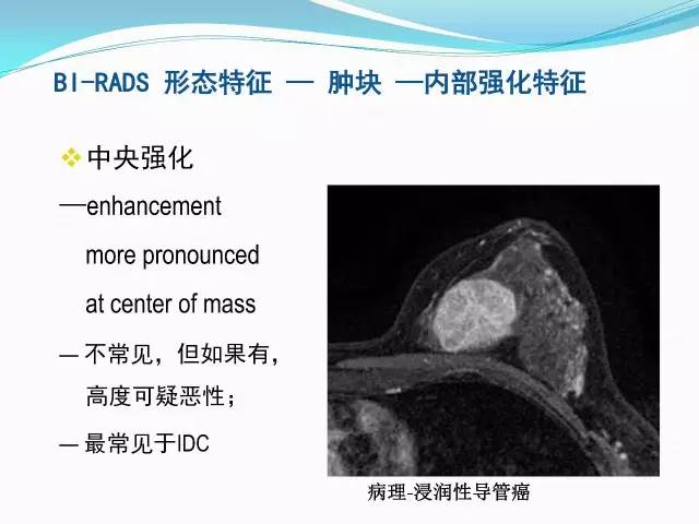 【PPT】新版乳腺MR BI-RADS术语及分类的解读