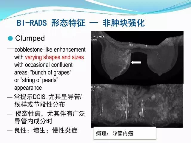 【PPT】新版乳腺MR BI-RADS术语及分类的解读