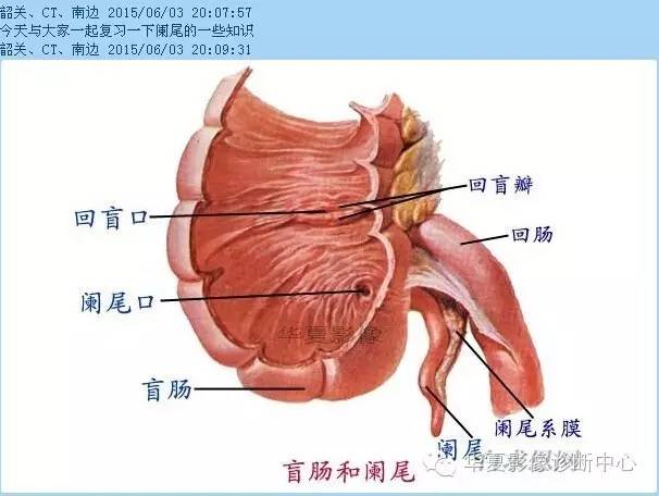 教你如何快捷、准确的找到阑尾并分析病变