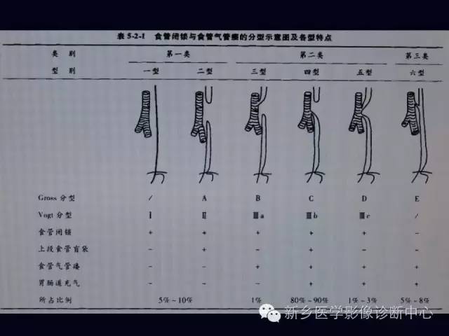 【PPT】小儿腹部急症的X线诊断