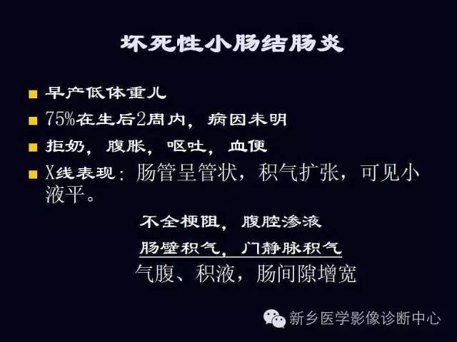 【PPT】小儿腹部急症的X线诊断