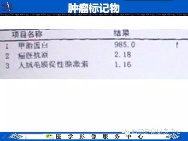 【病例】纵隔混合性生殖细胞瘤1例CT影像表现