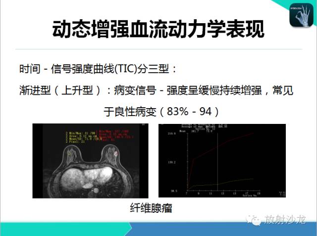 【PPT】乳腺病变的MR诊断