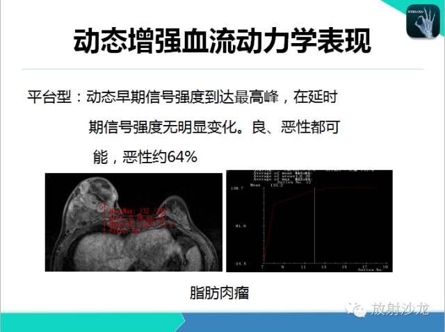 【PPT】乳腺病变的MR诊断