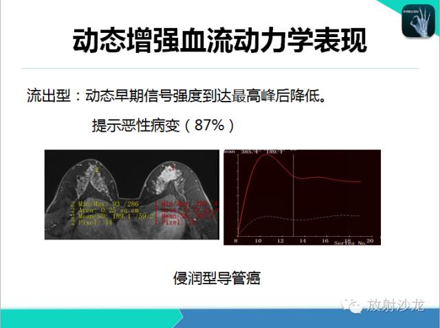 【PPT】乳腺病变的MR诊断
