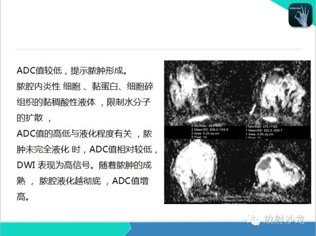 【PPT】乳腺病变的MR诊断