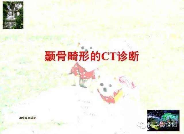 【PPT】颞骨畸形的CT诊断