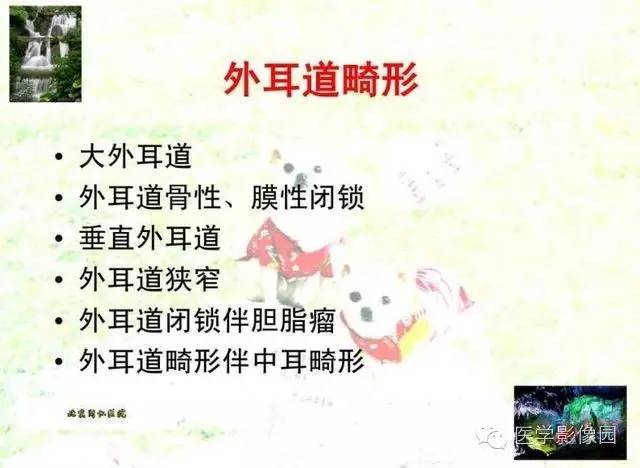 【PPT】颞骨畸形的CT诊断