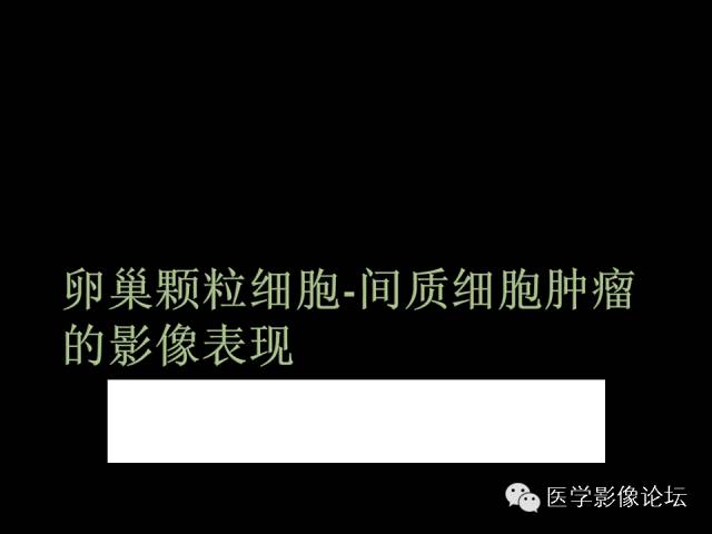【PPT】卵巢颗粒细胞-间质细胞肿瘤的影像表现