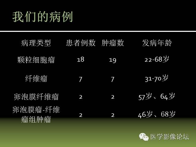 【PPT】卵巢颗粒细胞-间质细胞肿瘤的影像表现 【PPT】卵巢颗粒细胞-间质细胞肿瘤的影像表现