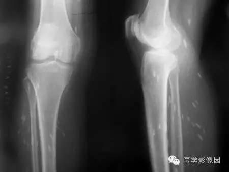 “囊虫病”图文精讲 “囊虫病”图文精讲