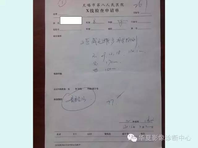 【PPT】儿童骨龄、成年身高测评