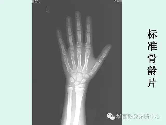 【PPT】儿童骨龄、成年身高测评