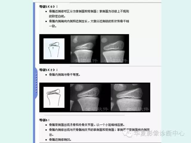 【PPT】儿童骨龄、成年身高测评