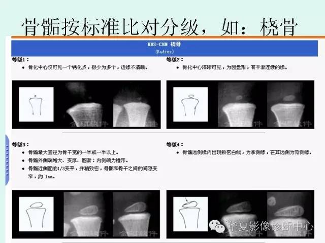 【PPT】儿童骨龄、成年身高测评