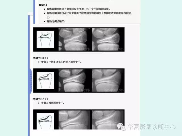 【PPT】儿童骨龄、成年身高测评
