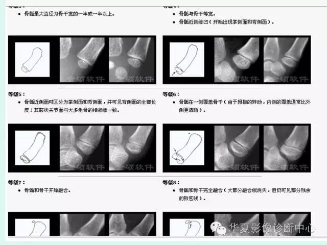 【PPT】儿童骨龄、成年身高测评