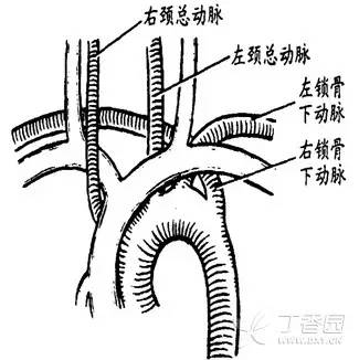 不走寻常路：先天性心脏和大血管位置异常影像解析