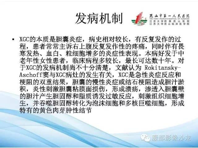 【病例】黄色肉芽肿性胆囊炎1例CT影像表现 【病例】黄色肉芽肿性胆囊炎1例CT影像表现