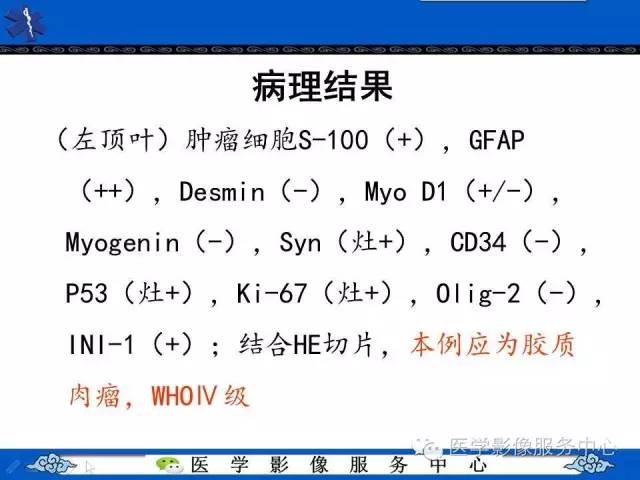 【病例】左额叶胶质肉瘤1例MR影像表现