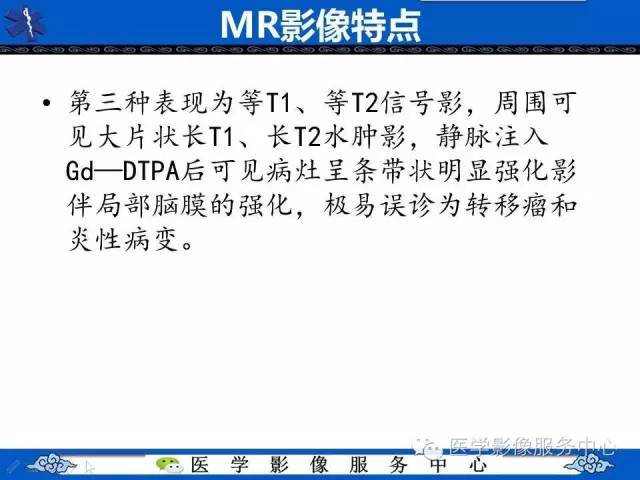 【病例】左额叶胶质肉瘤1例MR影像表现
