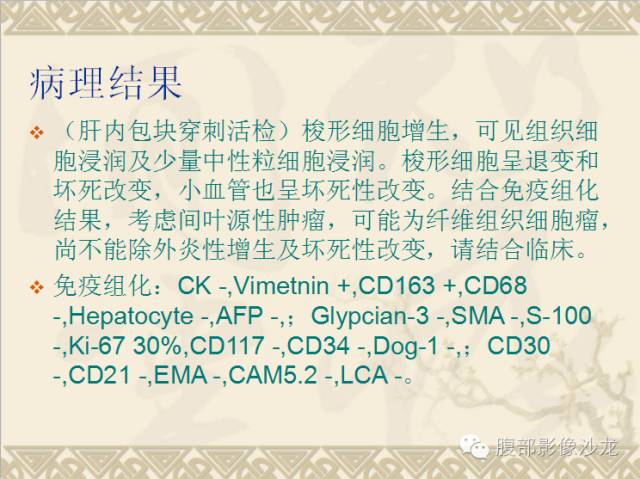 【病例】肝脏纤维组织细胞瘤1例CT影像表现 【病例】肝脏纤维组织细胞瘤1例CT影像表现