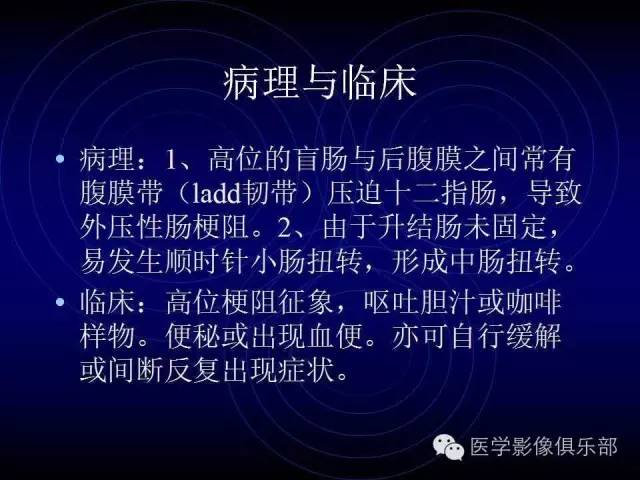 【PPT】婴幼儿消化道梗阻性疾病