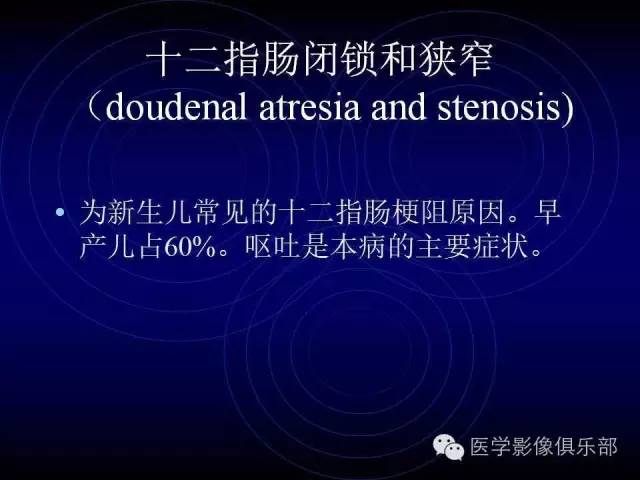 【PPT】婴幼儿消化道梗阻性疾病